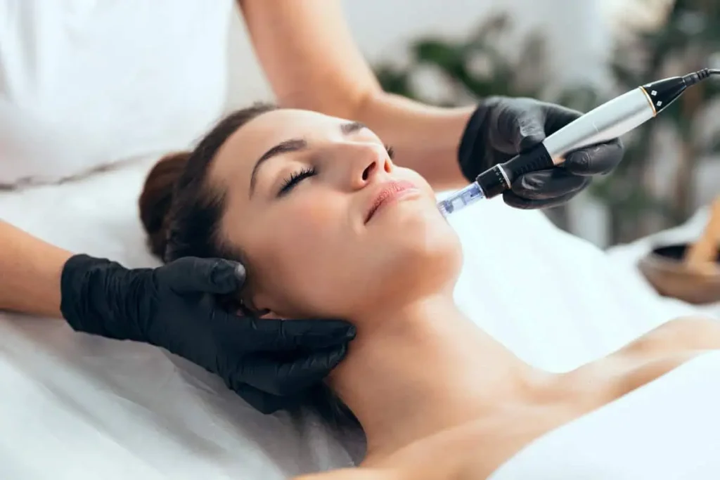 Microneedling procedure in Hollywood, FL