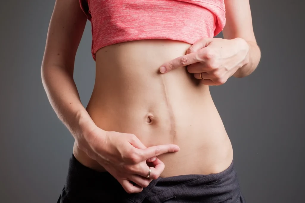 Scar Tissue and Healing Optimization Treatment in Hollywood, FL
